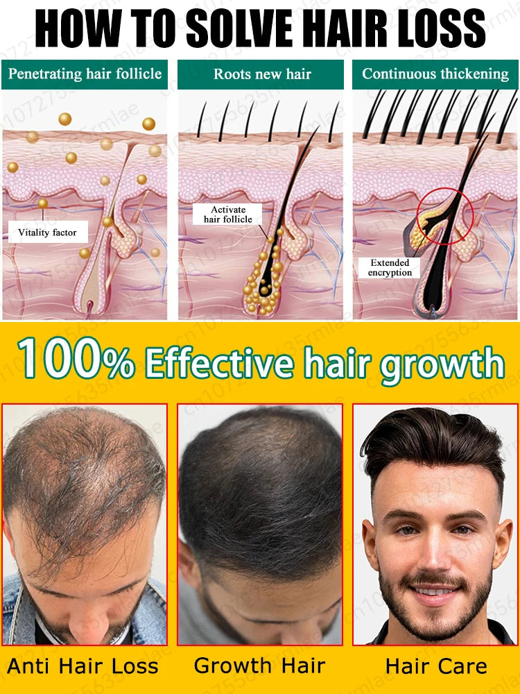 Hair growth oil,effective baldness repair