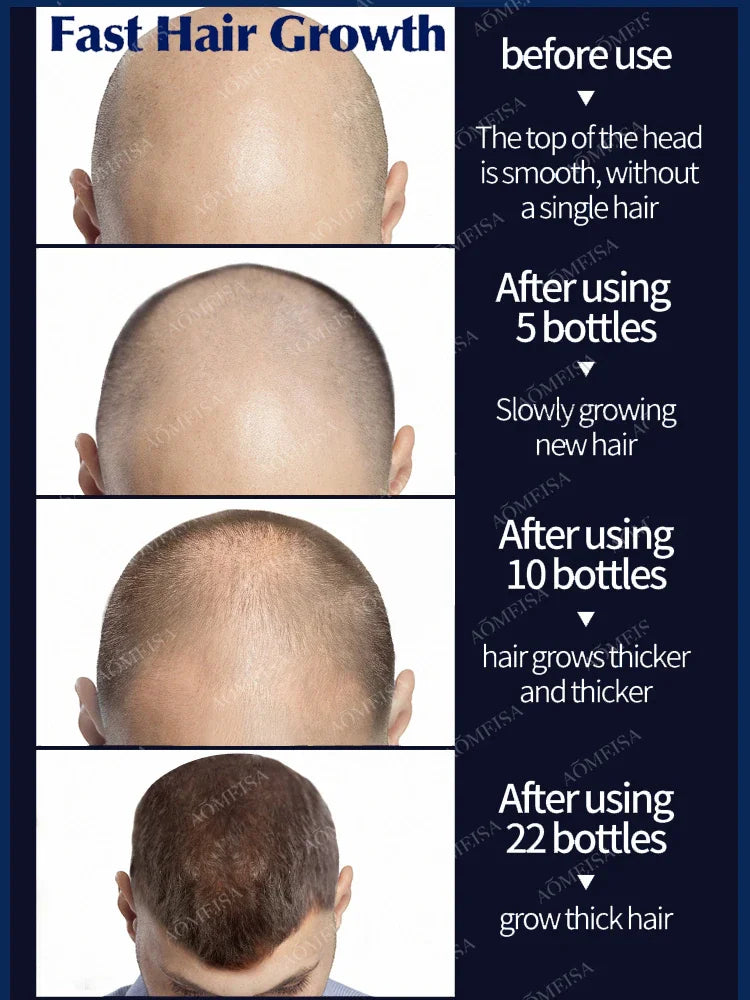 Hair growth oil,effective baldness repair