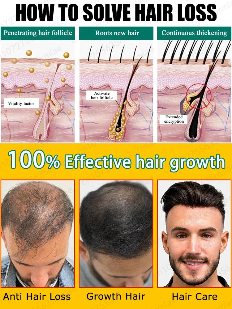 Rapid hair growth essential oil, repair baldness