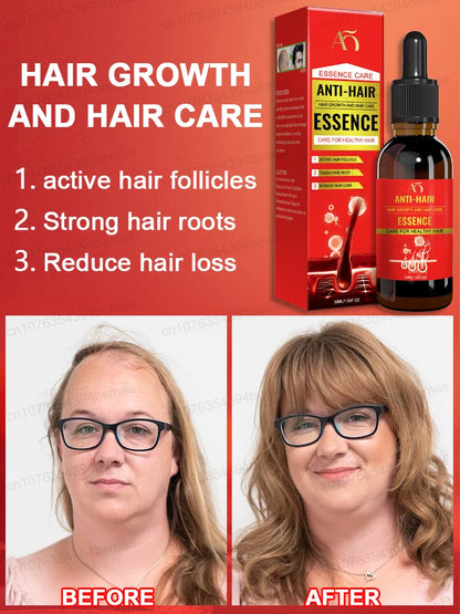 Rapid hair growth essential oil, effectively repairs baldness and hair loss problems and activates hair follicles