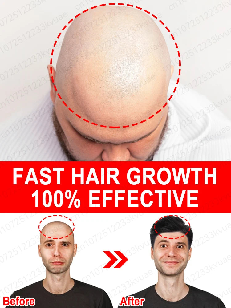 Hair Growth Oil Fast Hair Growth Effective Baldness Repair Hereditary Hair Loss Postpartum Hair Loss Seborrheic Hair Loss