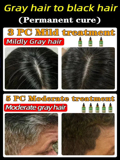 Anti Gray Hair Serum Remedy White Darkening Products