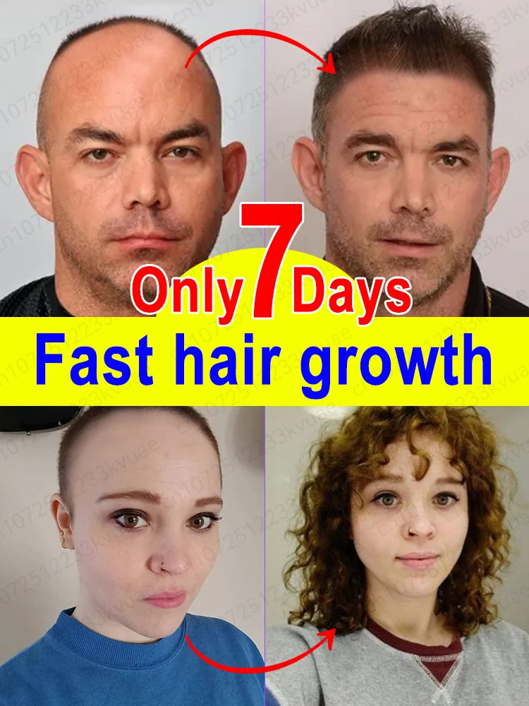 Hair Growth Oil Fast Hair Growth Effective Baldness Repair Hereditary Hair Loss Postpartum Hair Loss Seborrheic Hair Loss