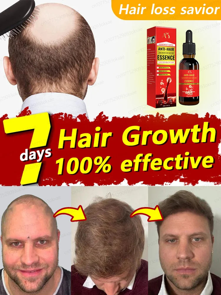 Hair Growth Oil Fast Hair Growth Effective Baldness Repair Hereditary Hair Loss Postpartum Hair Loss Seborrheic Hair Loss